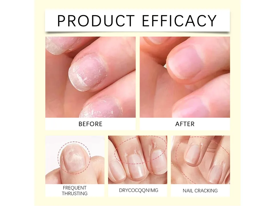 Before and after comparison of nails showing improved cuticle health.
