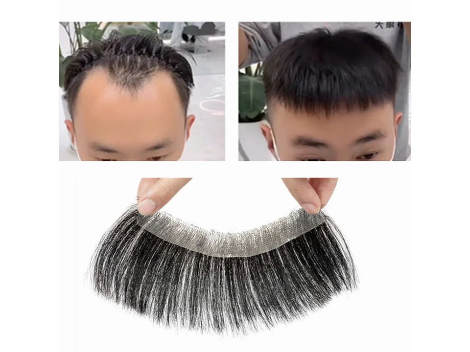 Before and after comparison of a man wearing the hairpiece.